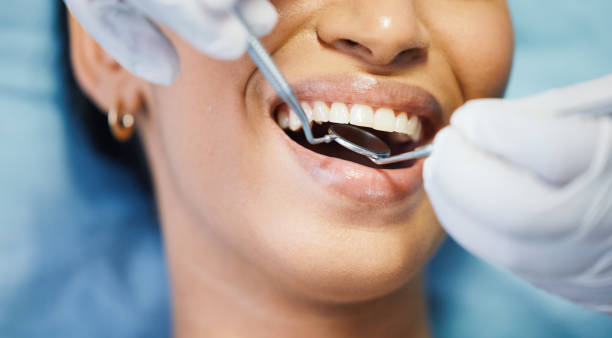 Best Emergency Broken Tooth Repair in Romoland, CA